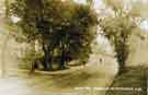 View: arc02582 Fulwood Road, looking down towards Nethergreen.  Far building (centre of picture) is No. 471 Rising Sun Inn     